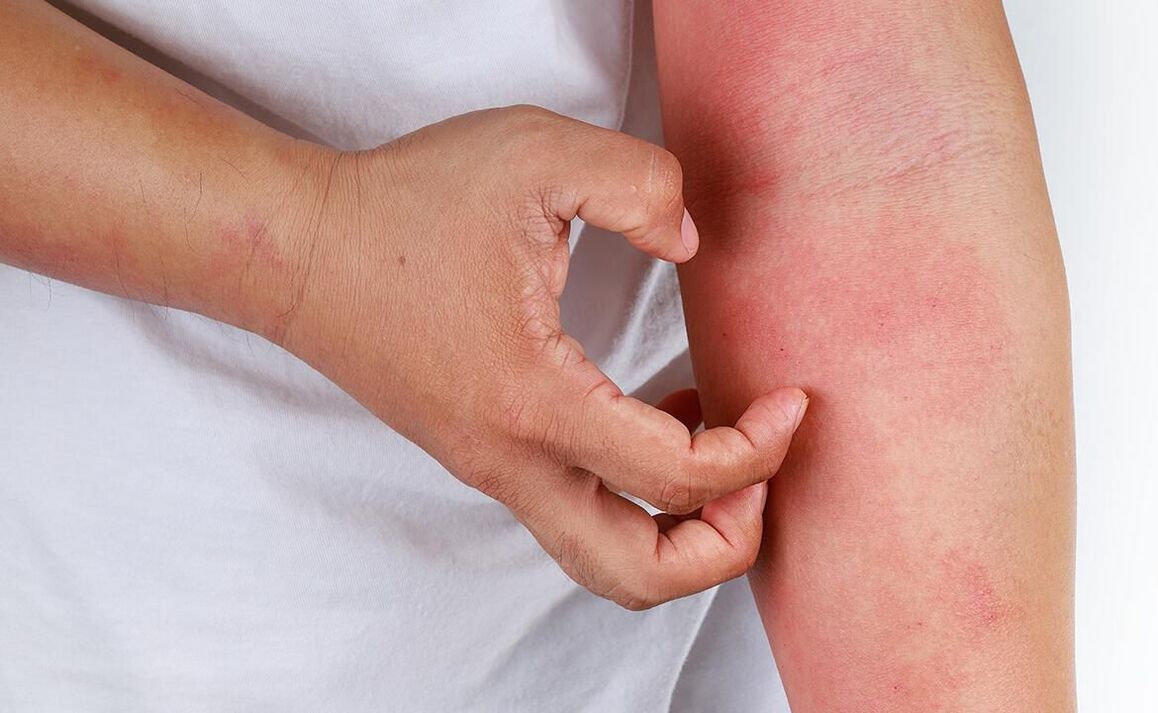 možné komplikácie pri používaní sódy